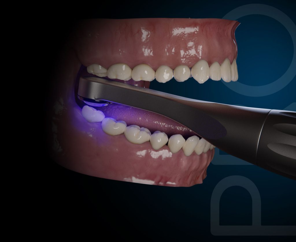 now-black-pro-boca-01_v2