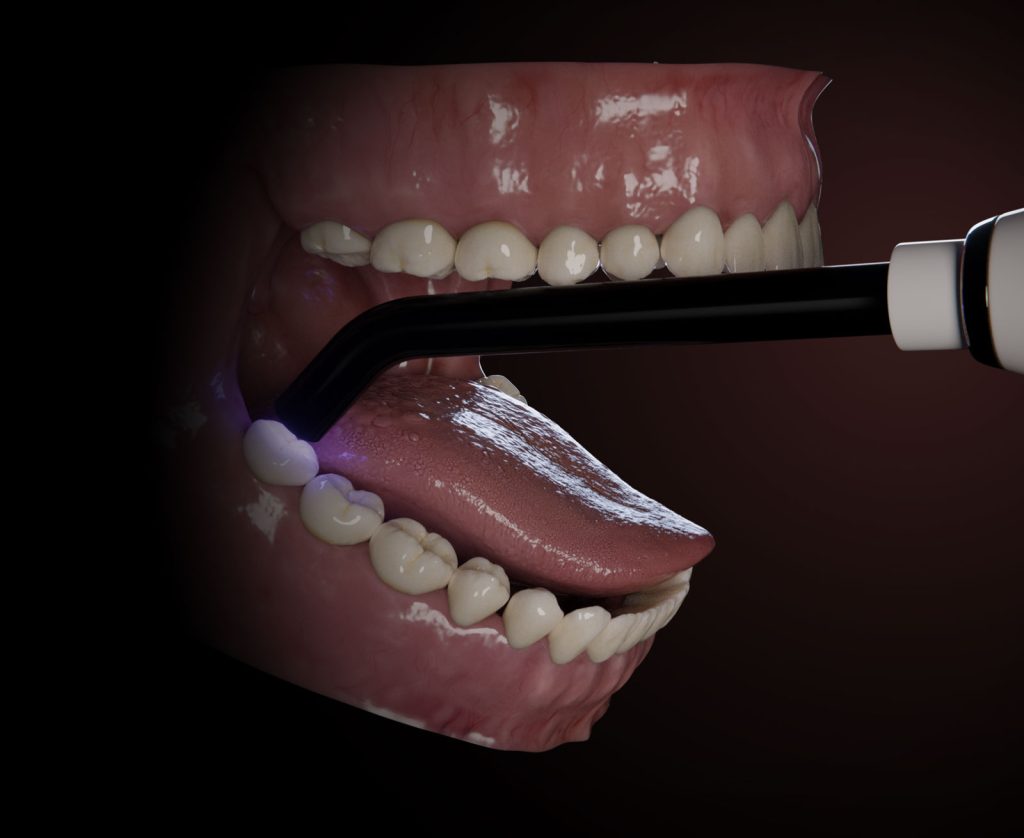 now-black-pro-boca-02_v2